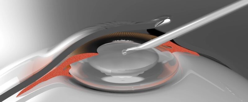 医療分野向け3DCG制作|健康器具・医療機器プロモーションCG動画 5 SC2025107154656