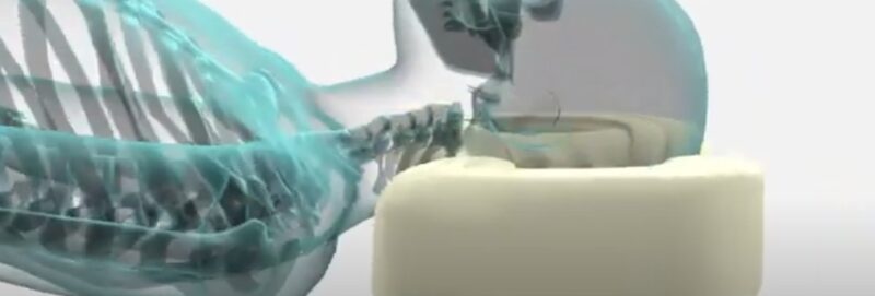 医療分野向け3DCG制作|健康器具・医療機器プロモーションCG動画 6 SC2025107155035